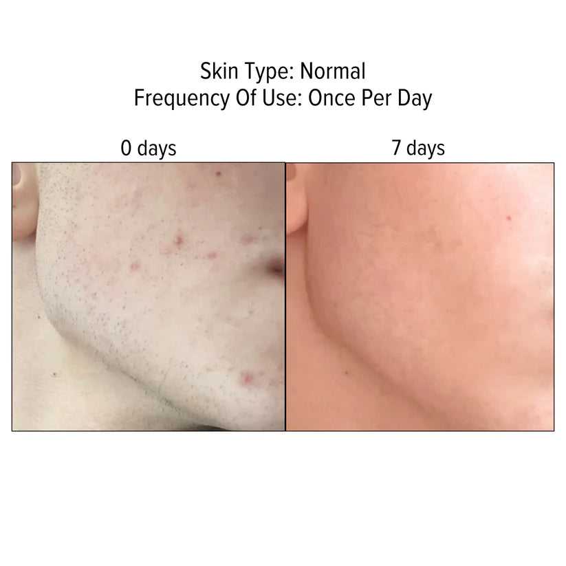 10% Niacinamide Serum